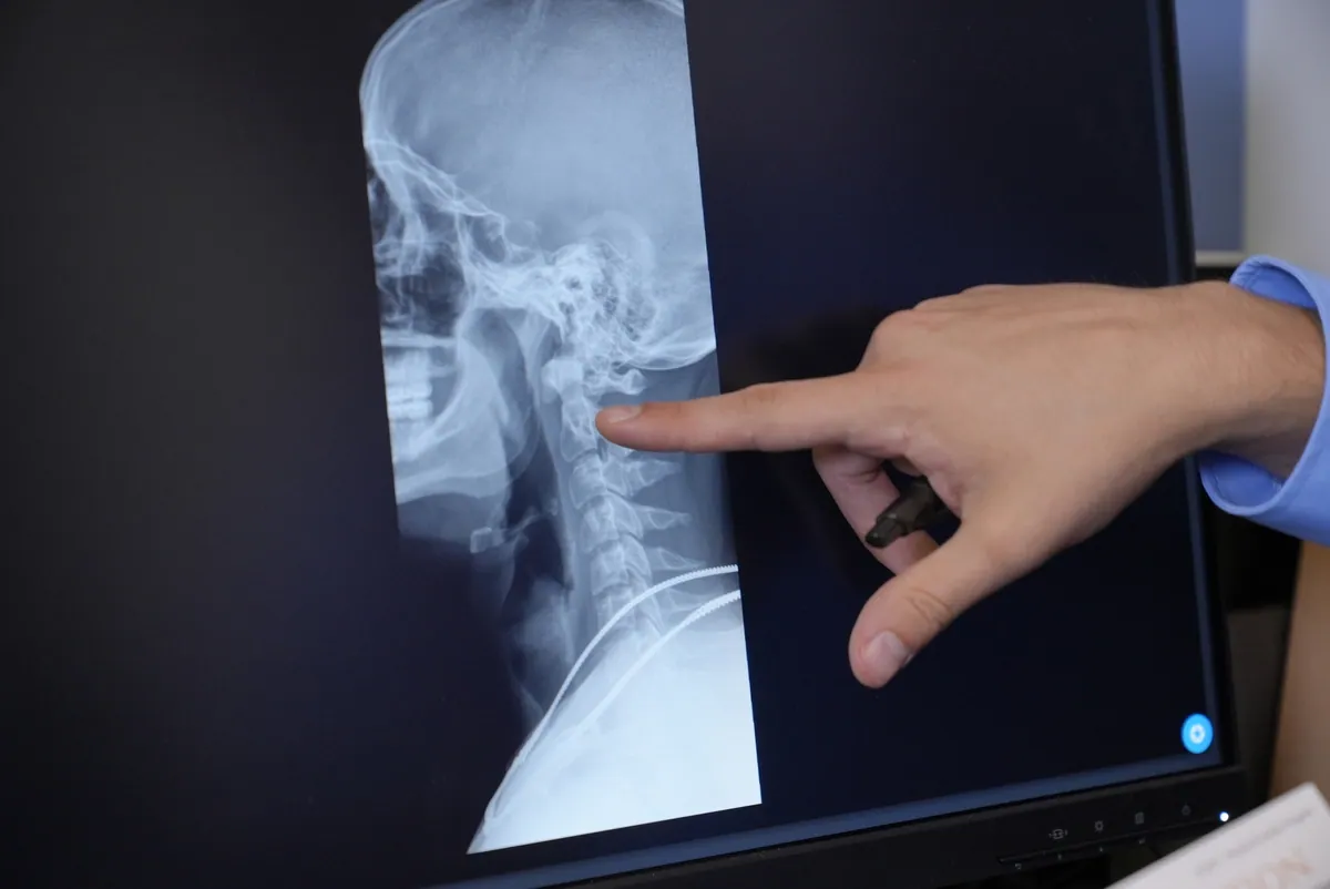 Reviewing a neck x-ray on screen