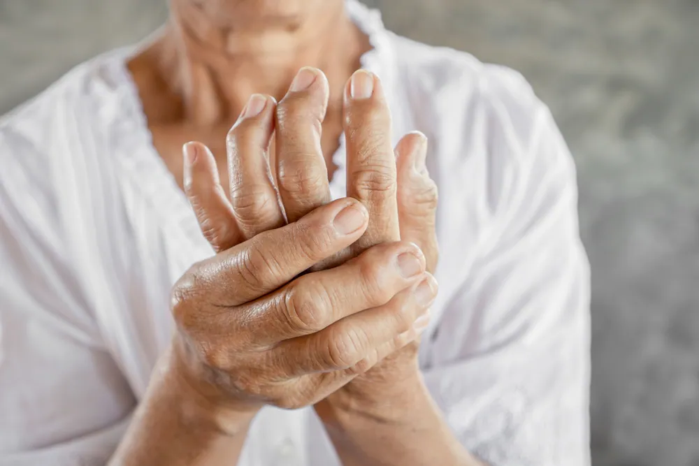 Arthritis Treatment