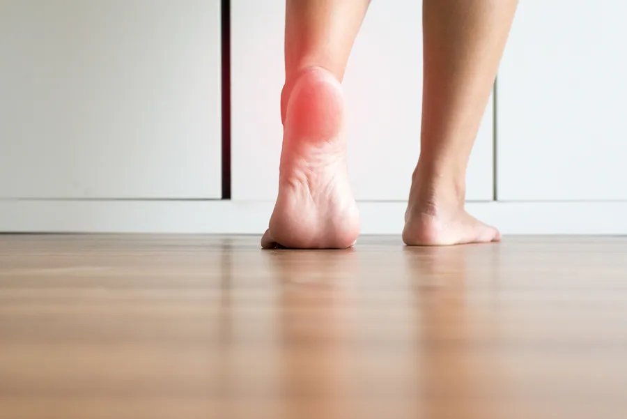 Plantar Fasciitis at Chagrin River Chiropractic in Mentor, OH